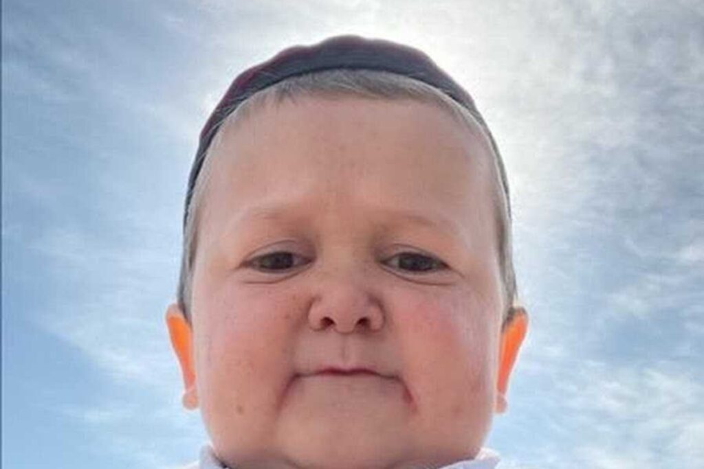 fortune hasbulla (4)