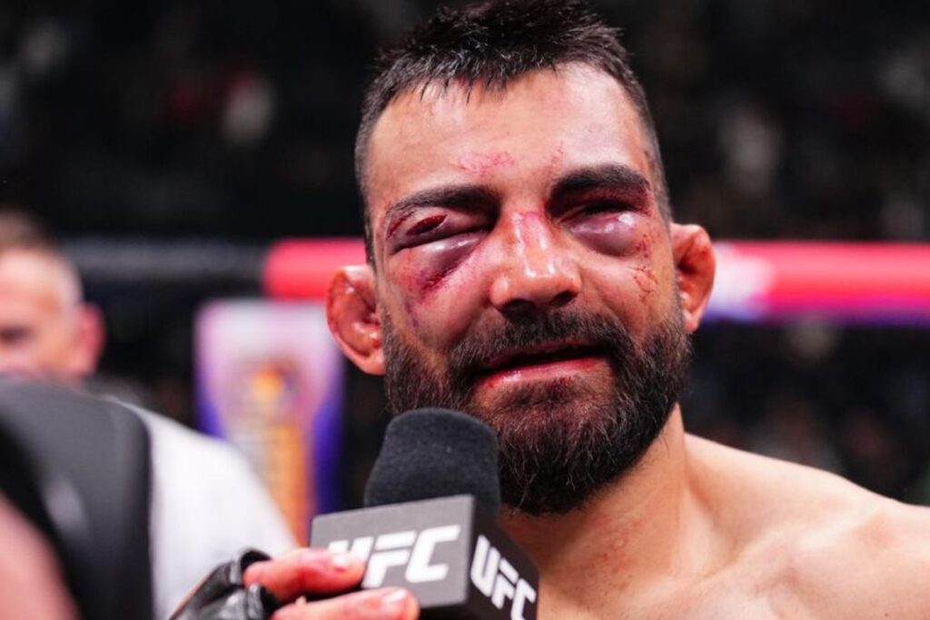 benoit saint denis prochain combat (1)